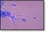 fusarium